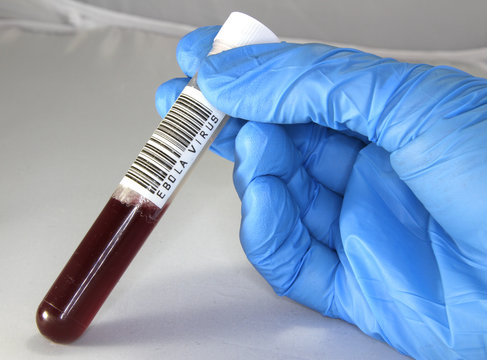 doctor examines a tube with blood infected with ebola virus