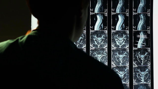 Studying MRI spinal scan, spine x-ray, doctor making a diagnosis