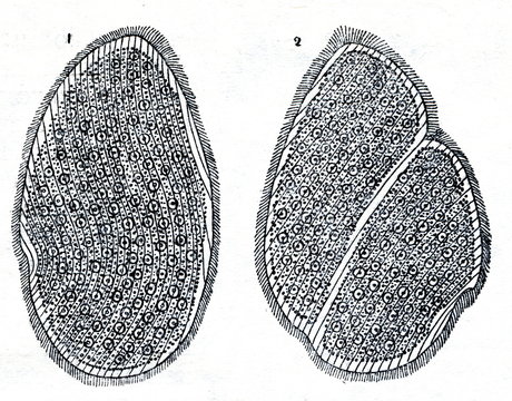 Opalina ranarum (right - dividing)