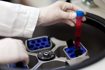 Modern robotical machine for centrifuge blood