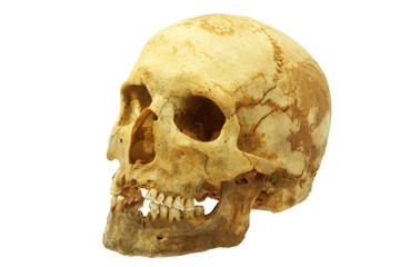 Genuine human skull isolated on white, lipids makes skull yellow