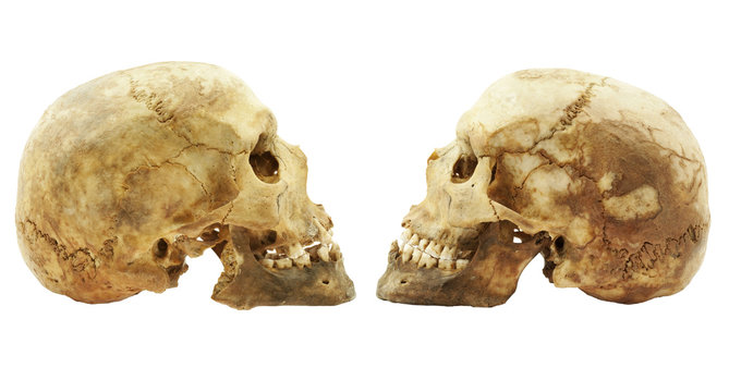 Genuine human skull isolated on white, lipids makes skull yellow