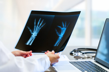 Doctor hands holding x ray at desk.