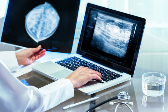 Doctor reviewing mammography results on pc.