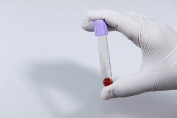 Blood test tube in a laboratory