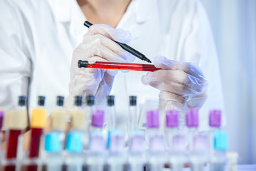 Test tube with blood sample in doctor hand