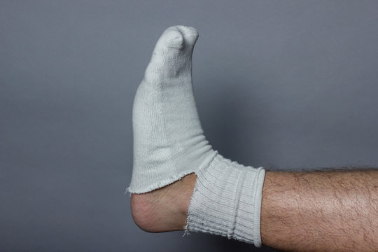 Kaputte Socke tragen