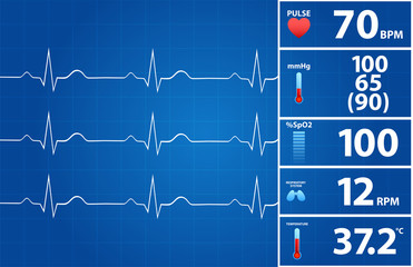Blueprint Of Modern Electrocardiogram Monitor