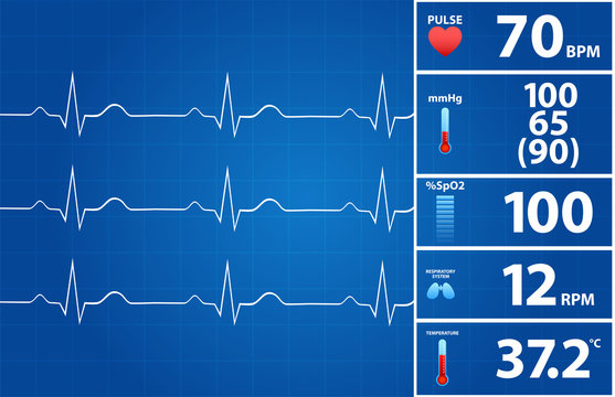 Blueprint Of Modern Electrocardiogram Monitor