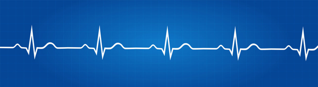 Blueprint Of Normal Electrocardiogram Graphic