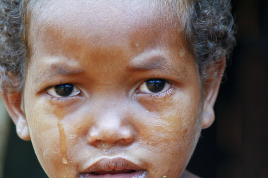 Crying girl with tear on cheek - poor african child