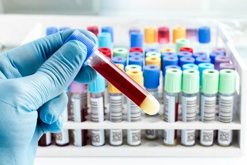 laboratory technician holding a blood tube test - obrazy, fototapety, plakaty