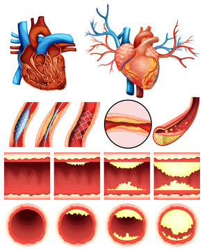 Heart cholesterol