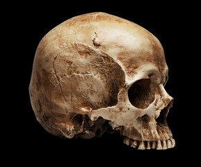 skull without jaw