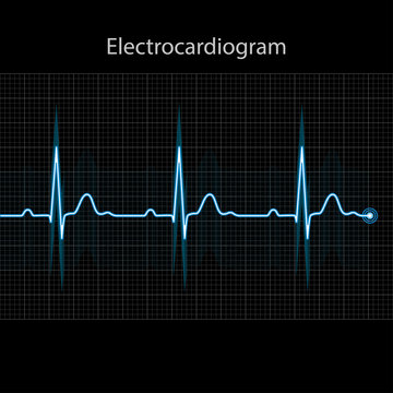 Electrocardiogram 2d illustration