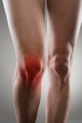 Sore woman's knee with red spot. Joint illness or disease.