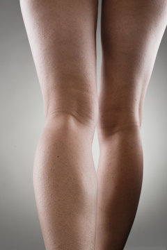 Woman's leg calves over grey. Muscular hurt concept.