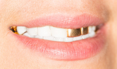 gold teeth girl