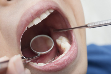 Dental checkup