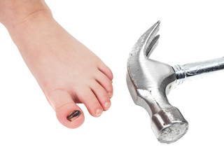 Child showing blue toenail barefoot and hammer head