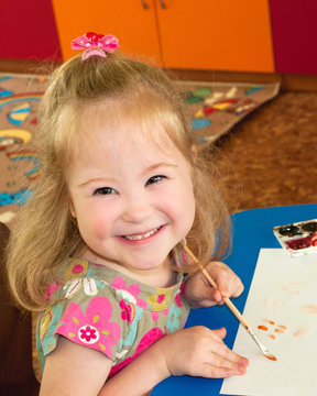 Girl,syndrome, down syndrome