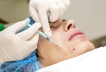 Cosmetic treatment with injection in a clinic