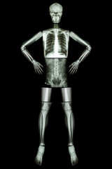 Human bone stand and akimbo ( X-ray whole body )