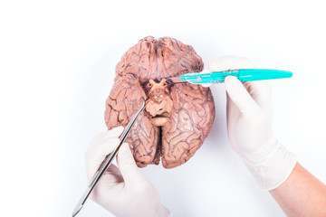 human brain dissection