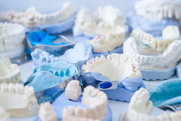 Dental plaster moulds and imprints