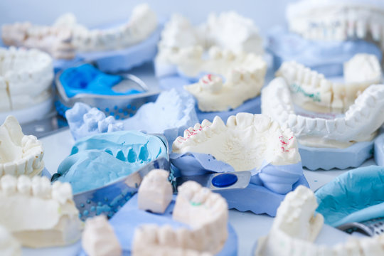 Dental plaster moulds and imprints