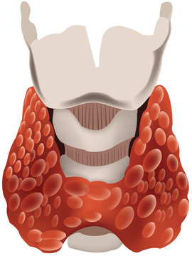 tiroide
