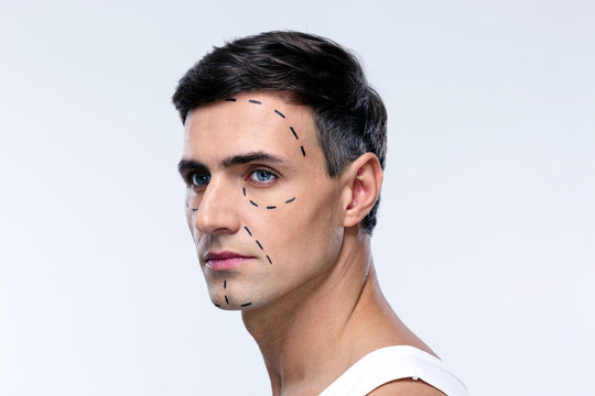 Man marked with lines for plastic surgery looking away