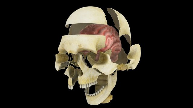 Skull with brain