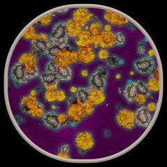 Obraz na płótnie Canvas Symmetrical growth of bacteria