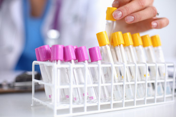 Woman researcher is surrounded by medical vials and flasks,