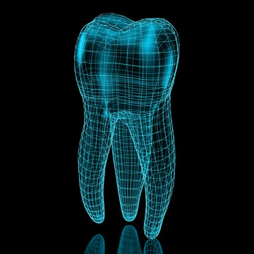 Tooth mesh