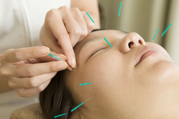 Fototapeta premium Acupuncturist to refer to acupuncture to face