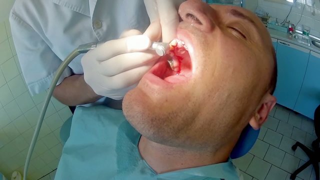 Dental care and hygiene