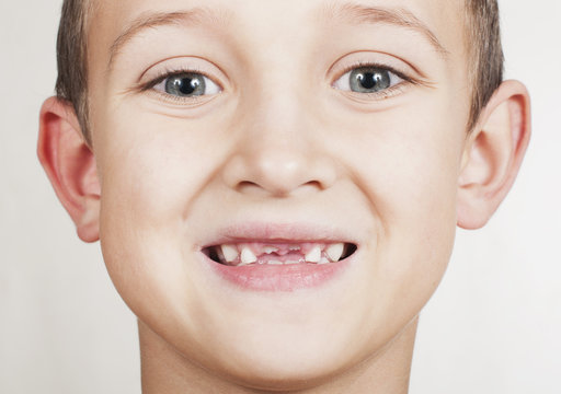 loss of primary teeth in children