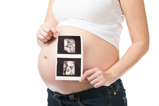Pregnant woman showing ultrasonography picture