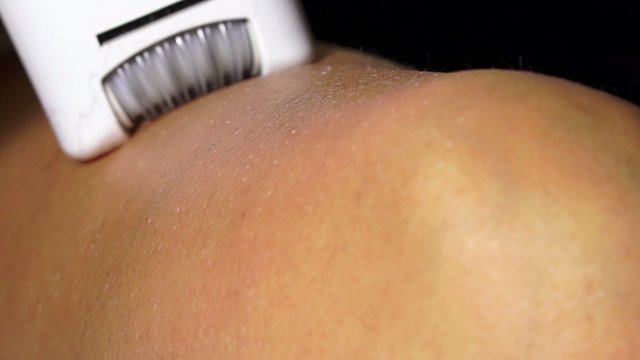 Esthetician doing depilation