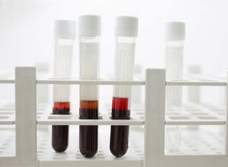 Blood samples are analyzes in the container