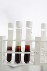 Blood samples are analyzes in the container