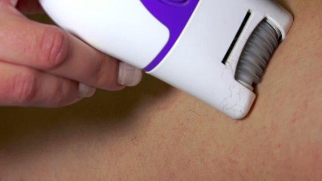 Depilation. Beauty and skin body care concept