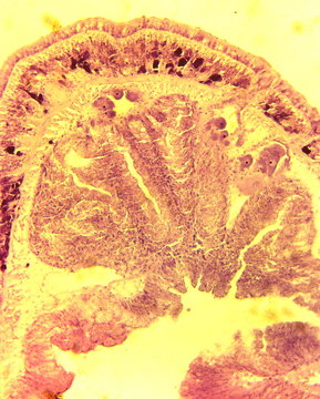 Nemertine worm (Lineus gesserensis) transverse slit slide plate