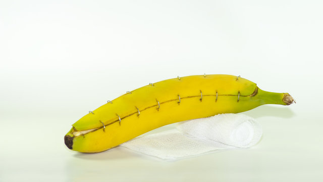 Banane mit Wundverschlu&szlig;