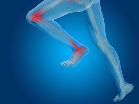 Conceptual human body anatomy pain on blue