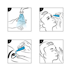 Eye drops - applying
