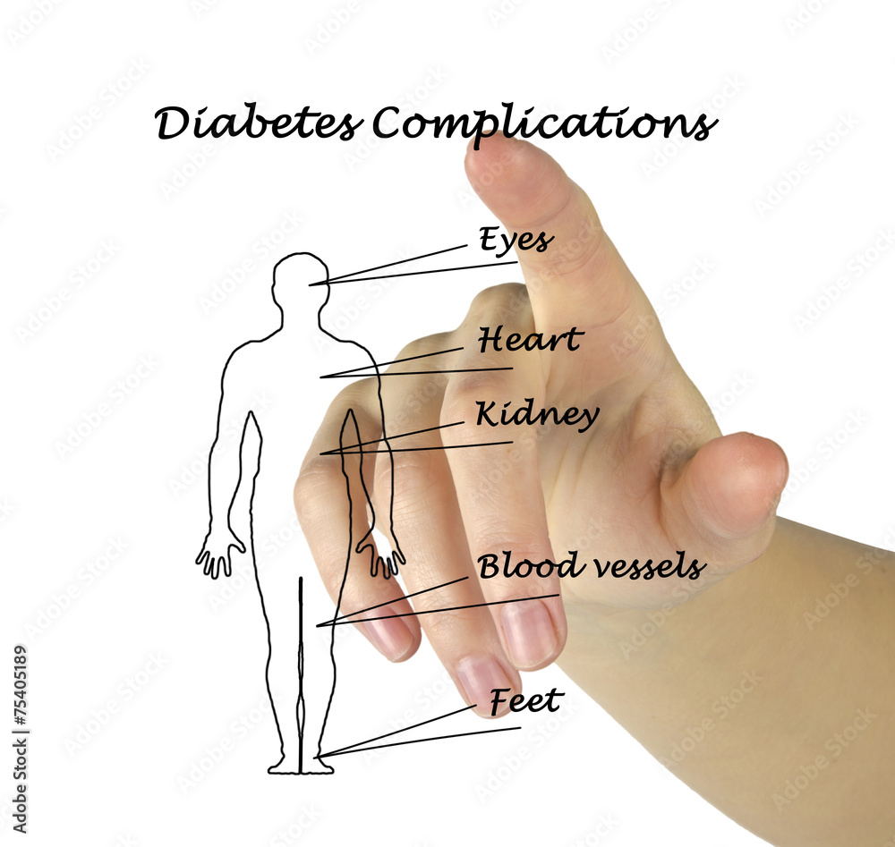 Poster diabetes complications