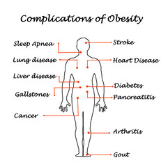 Complications of Obesity